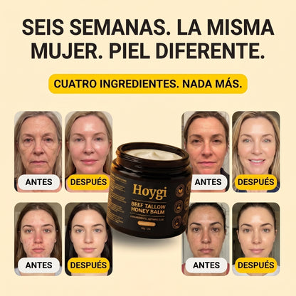 Hoygi Beef Tallow Balm para hombres y mujeres