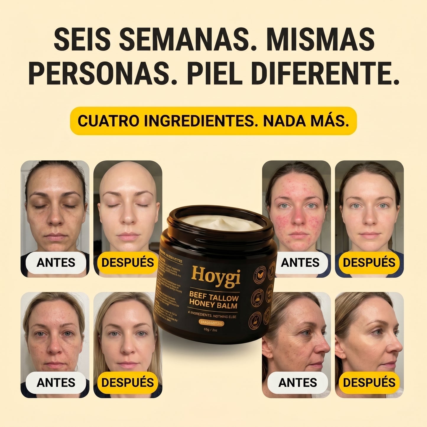 Hoygi Beef Tallow Balm para hombres y mujeres
