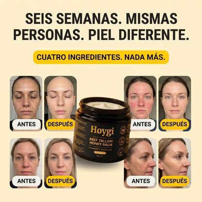 Hoygi Beef Tallow Balm para hombres y mujeres