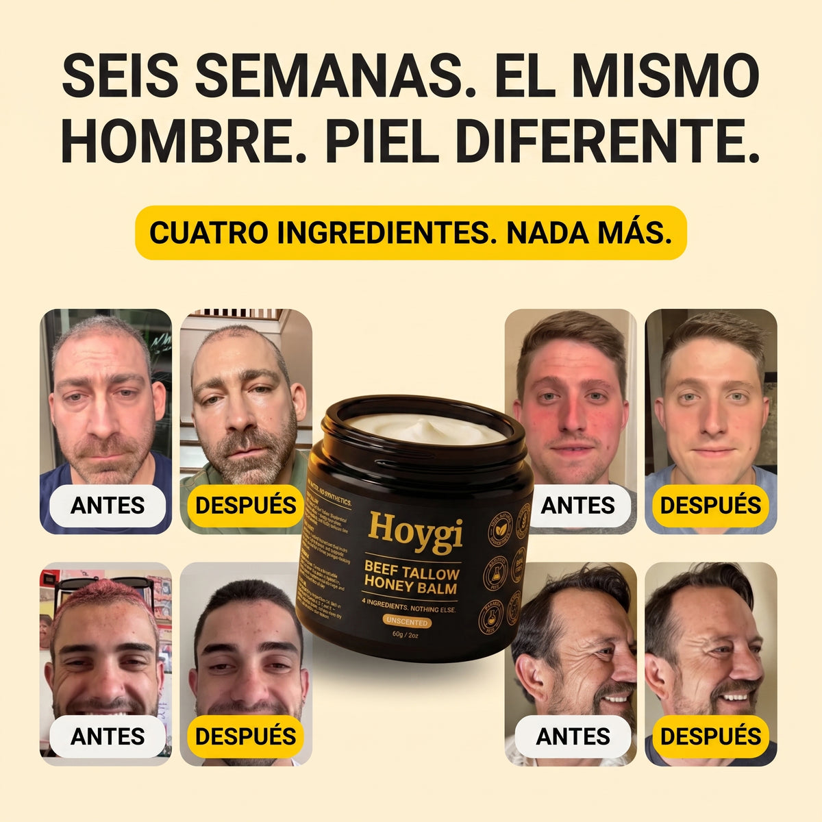 Hoygi Beef Tallow Balm para hombres y mujeres