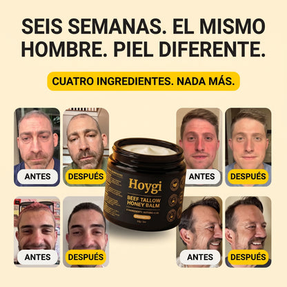 Hoygi Beef Tallow Balm para hombres y mujeres