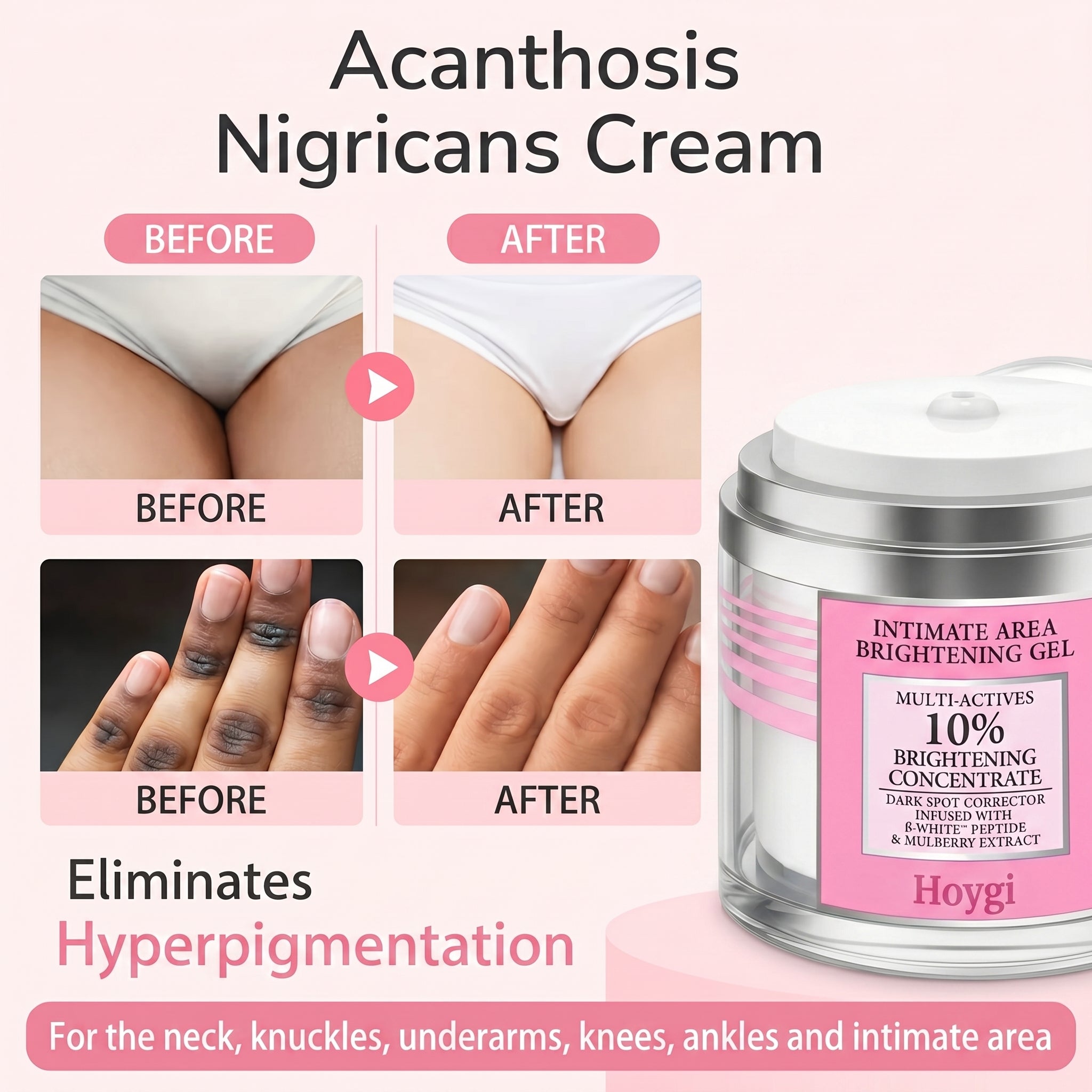 Intimate Dark Spot Remover for Body, Face, Bikini and Sensitive Areas