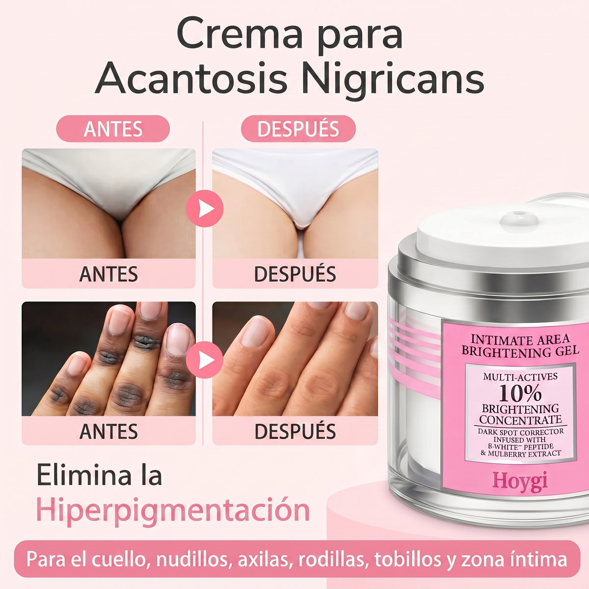 Hoygi Blanqueador de Zona Intima, Axilas, Manos, Codos y otras zonas del cuerpo